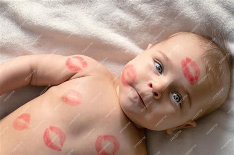 Bolinha De Beijo Em Bebe