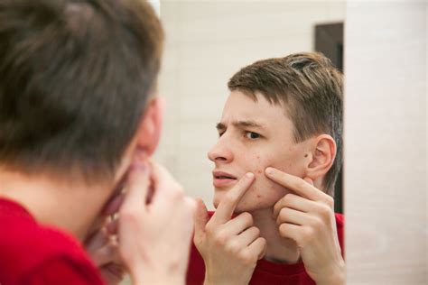 Врач Прокофьева: Выдавливание прыщей на лице может вызывать тяжёлое ...