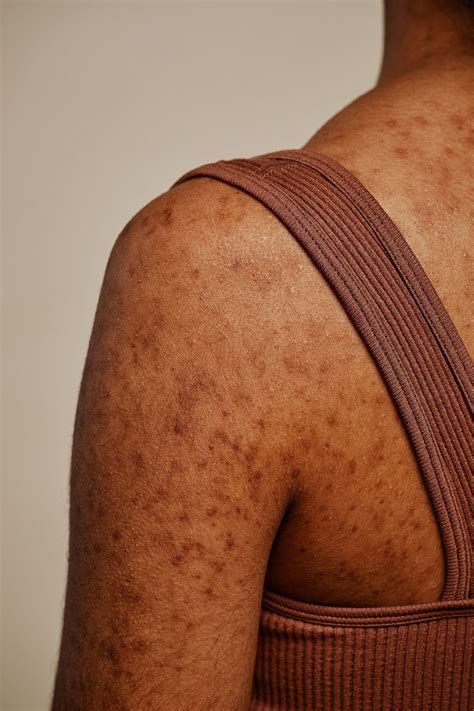 Are your hormones unbalanced—and what does that even mean?