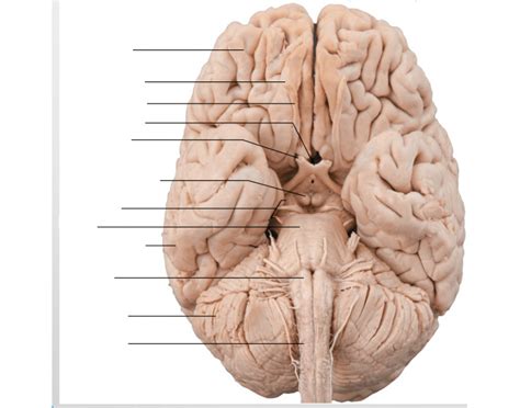 ventral aspect   brain key terms  structures flashcards quizlet
