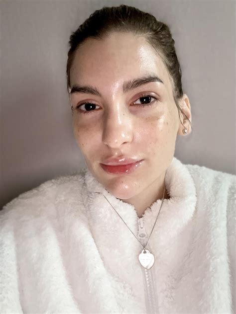 More freckles 4 more days to go & out of hospital & quarantine plus de