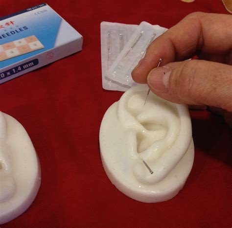 De Auriculoterapia 1