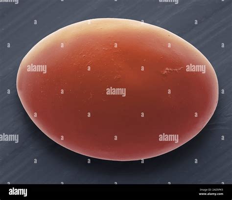 Tapeworm egg. Coloured scanning electron micrograph (SEM). Tapeworms ...