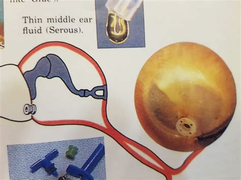 grommet insertion   hearing aid center  kothrud