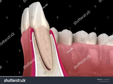 alveolar mucosa images stock  vectors shutterstock