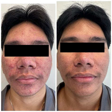 ALO Dermatology | Cebu City