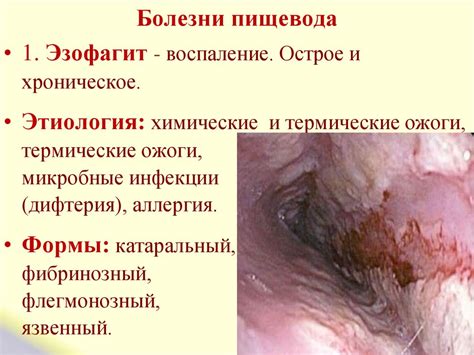 Патология пищеварительной системы - презентация онлайн