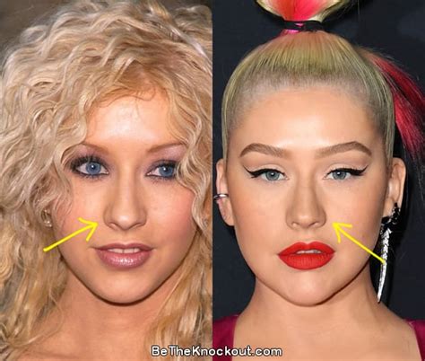 Christina Aguilera Plastic Surgery Comparison Photos