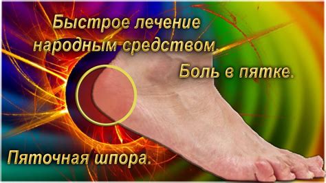 🦶 Боль в пятке. Пяточная шпора. Быстрое лечение народным средством ...