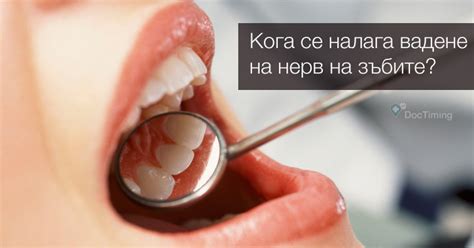Кога се налага вадене на нерв на зъбите | Блог | DocTiming