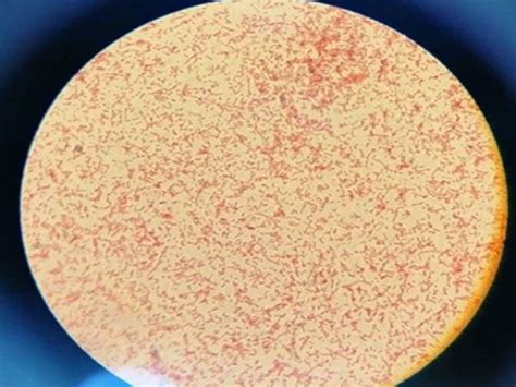 Citrobacter freundii isolates were discovered in a colony of the ...