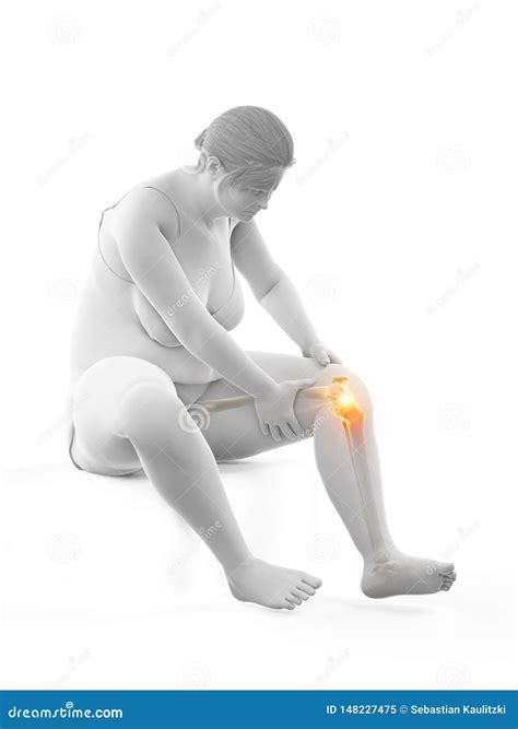 Painful knee joint stock illustration. Illustration of artwork - 148227475
