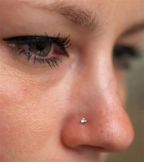 Piercing Bump Vs Keloid: Key Differences And Treatments