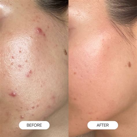 Shower Head Filter | Replacement Filter for Shower Head - Canopy