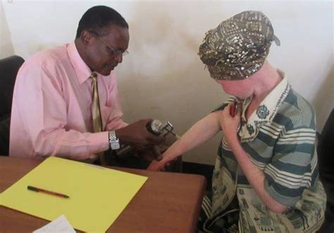 End skin cancer for people with albinism in Uganda - GlobalGiving