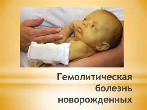 Гемолитическая желтуха новорожденных - презентация онлайн