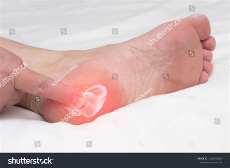 bone thorn pain images stock  vectors shutterstock