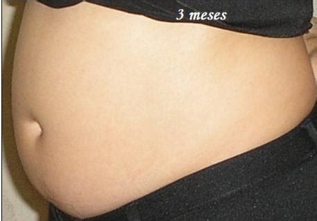 Barriga De Gravida De 3 Meses