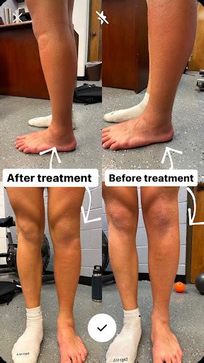 Reducing Leg Swelling After Travel? Quick Relief Tips – Tourist Places ...