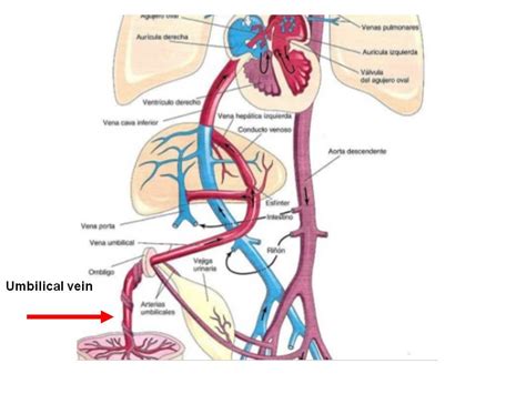 vena umbilical – Prodiagnosis / Foro Osler