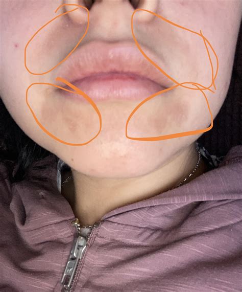 Hello, I’ve noticed I had these brownish spots in my face that were ok