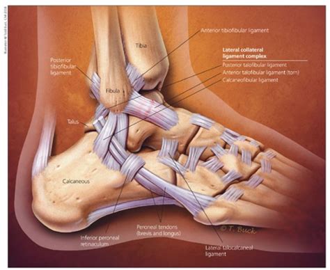 Explore the Anatomy: Clear Lateral Ankle Ligament Diagram Explained 22