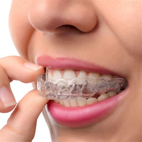 Dentist Montreal, QC - Dental Implants Periodontist - Cosmetic Dentist ...