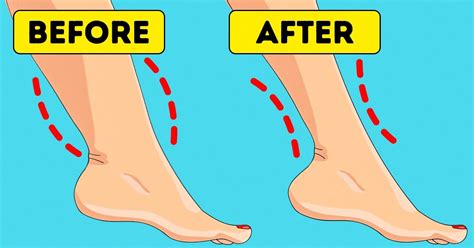 Why You Have Cankles and 7 Tips to Help You Deal Fix Them / Bright Side