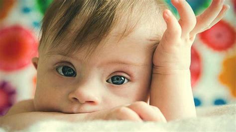 stem cell treatment   syndrome delhi india stem cell care