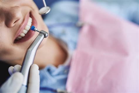 How Often Should You Get a Prophylaxis Cleaning in Rancho Bernardo