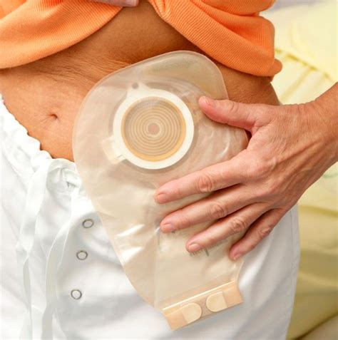 Colonoscopy Bag