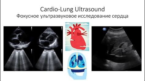 Фокусная кардио-пульмональная ультрасонография в условиях пандемии ...
