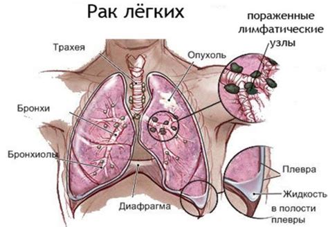 Щекочет в горле и вызывает кашель: причины, лечение | fr-dc.ru