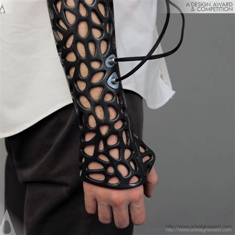 3D-printed cast concept uses ultrasound to heal broken bones - The Verge