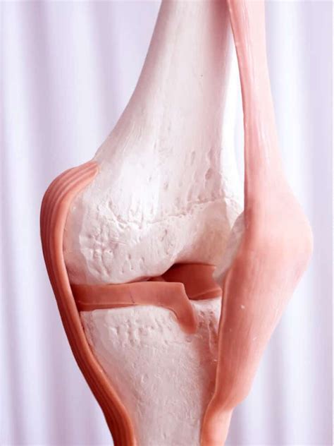 ACL Treatment Relief | Treatment in San Antonio & Schertz TX | BioMotion