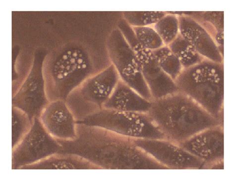 TSG inhibited growth of HepG2 cells. (a) The HepG2 cells were treated... | Download Scientific ...