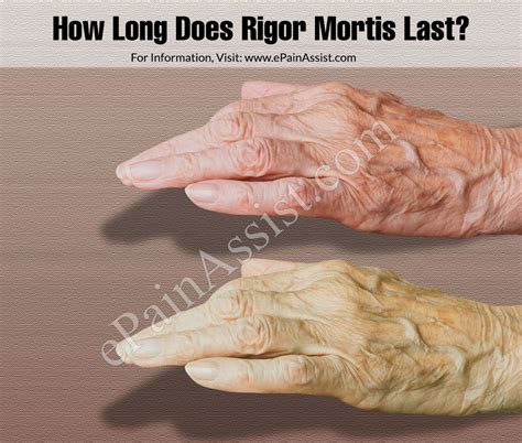 How Long Does Rigor Mortis Take To Set In