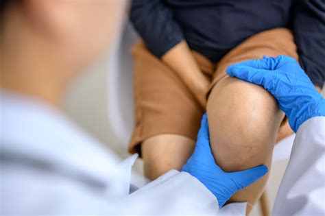 Wegovy eased osteoarthritis knee pain in people with obesity: study