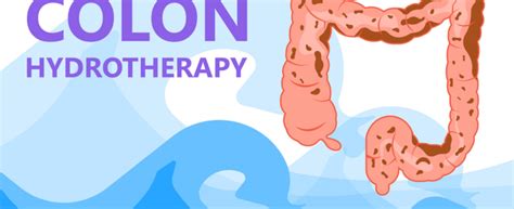 Hydrocolontherapy: benefits, advantages and treatments | Natur Life Style