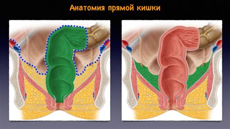 Визуализация прямой кишки и перианальной области