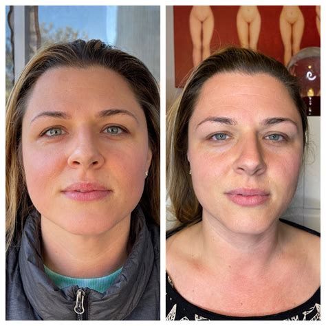 Face Reflexology