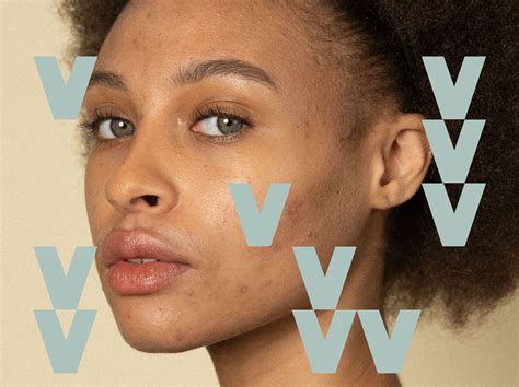 Preventing Hormonal Acne | Blog - Veracity | Veracity Selfcare | Clean ...