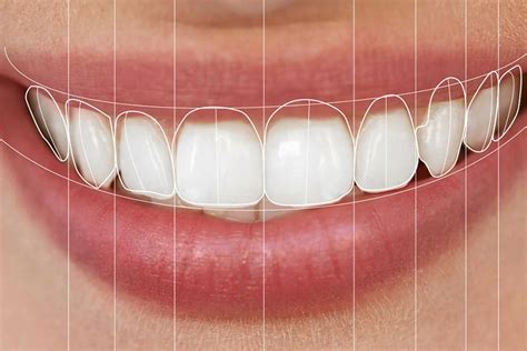 Digital Dental Design: Precision Redefined - CK Health Turkey