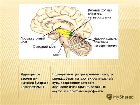 Презентация на тему: "Средний мозг простирается от переднего края моста ...