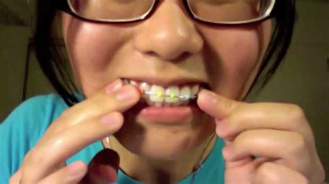 how to create fake braces