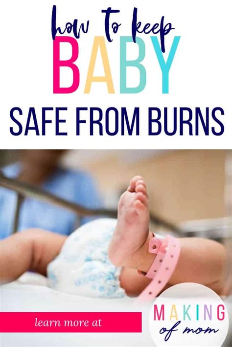 baby burn treatment    baby safe  burns  making  mom