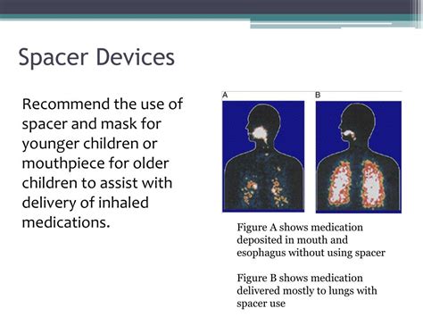emergency measures   nurses office asthma food allergies