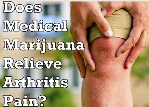 Does Medical Marijuana Relieve Arthritis Pain?