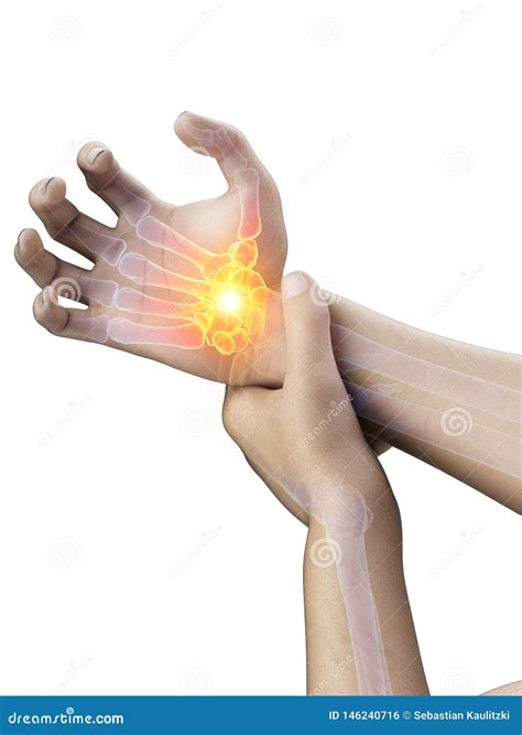 A painful wrist stock illustration. Illustration of body - 146240716