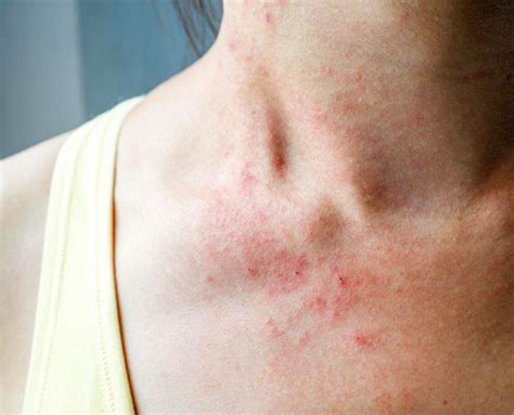 dermatology treatments skin conditions  procedures